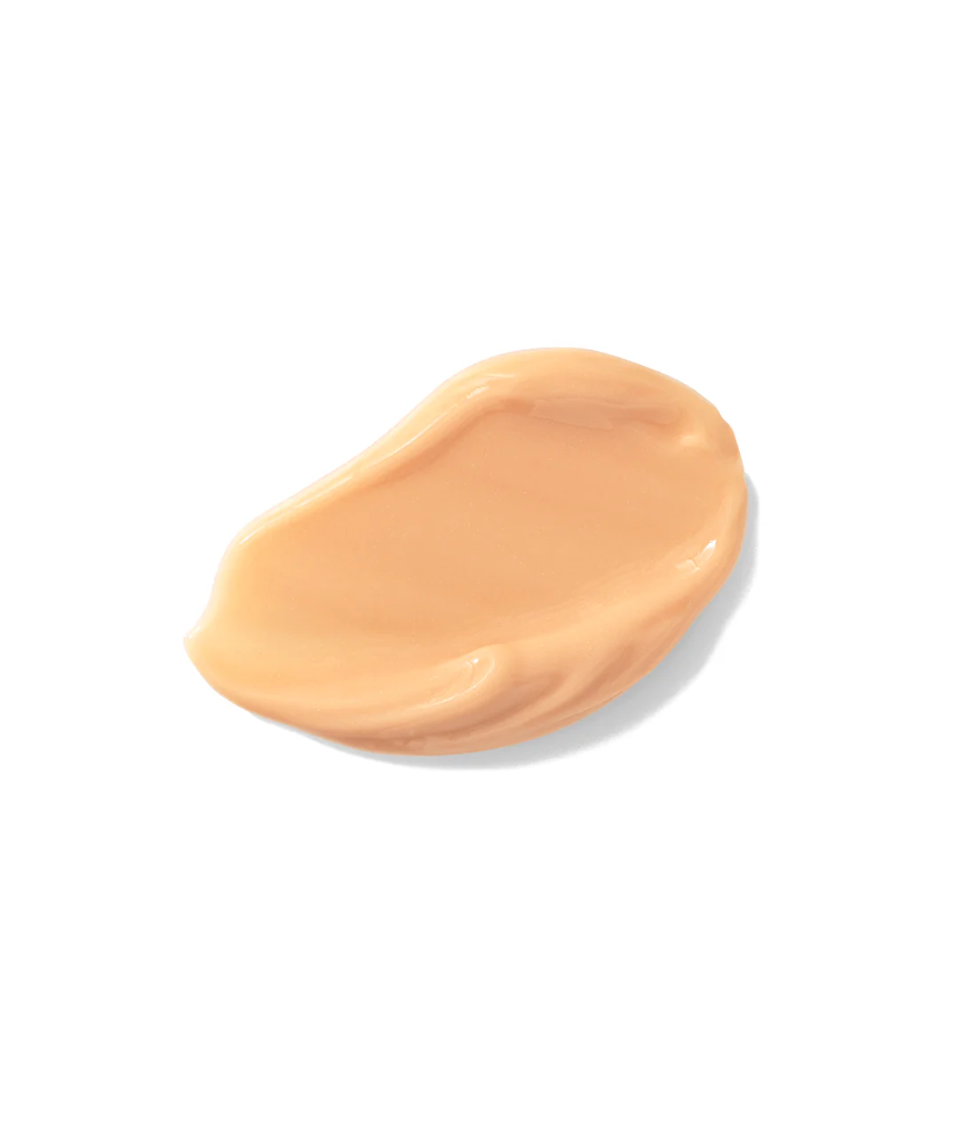 Ultra-Fill Marionette Line Treatment - Image 3